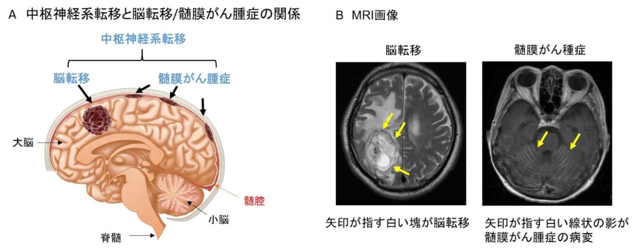 直売半額 MRI診断のための脳解剖図譜/医学書 | www.thermos.co.id