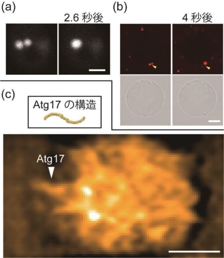液 液相分離がオートファジーを制御する仕組みを発見 オートファジー研究は次のフェーズへ 金沢大学 ナノ生命科学研究所