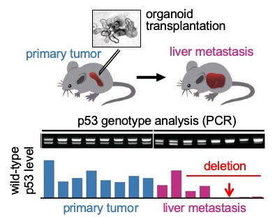 大腸がん転移を誘導するp53遺伝子の変異を発見